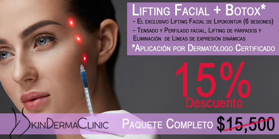 El mejor Rejuvenecimiento Facial Sin Cirugía con Resultados Reales lifting facial promociones dermatologos df